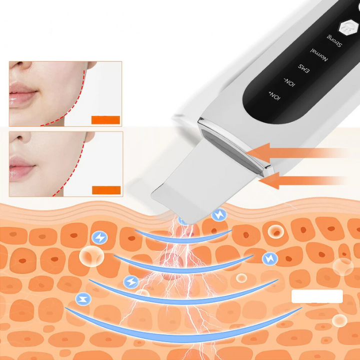 Radiantglow - Gesichtsporenreiniger und Blackhead -Entferner-4