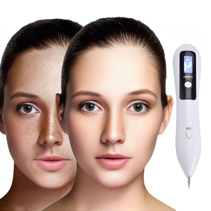 Clearskinpro -Laser -Plasma -Stift - Nicht -invasiv | Für Sommersprossen, Hautmarke, Fleck, Maulwurf und Tattoo zu Hause entfernen 3