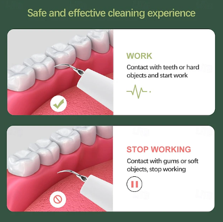 Dentora | Professioneller Ultraschall-Zahnsteinentferner für effektive Zahnpflege zu Hause 4