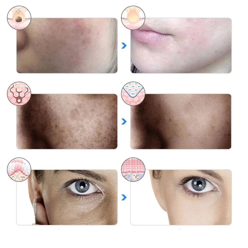 Altersglühen - 7 -Farben -LED -Therapiemaske für Gesichtsaufhebung und Aufhellung-5