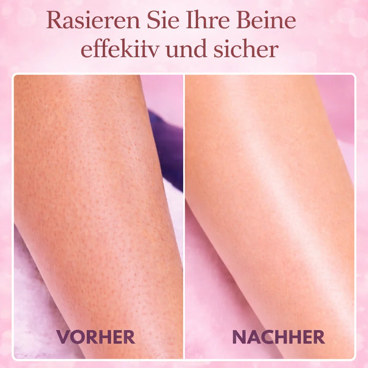 Intimrasierer Frauen | Elektrischer Rasierer für Damen | IntimLisse 4