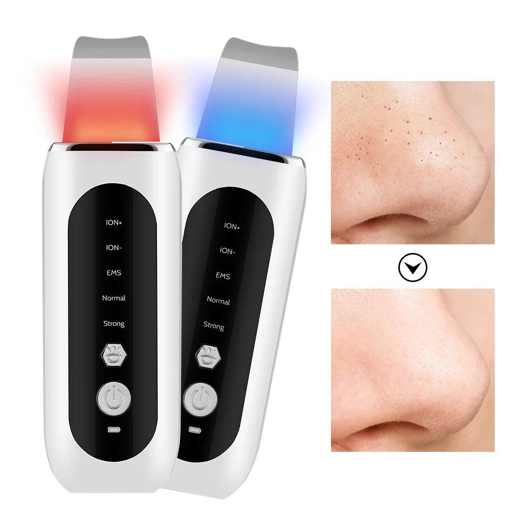Radiantglow - Gesichtsporenreiniger und Blackhead -Entferner-1